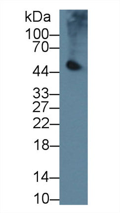 Western Blot; Sample: Recombinant protein.