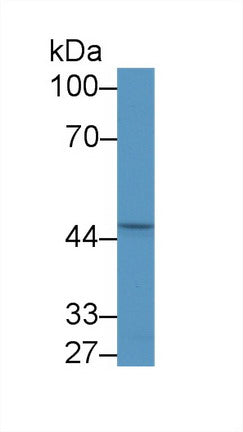 Used in DAB staining on fromalin fixed paraffin-embedded ovary tissue