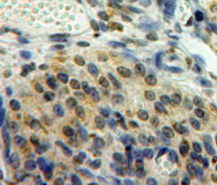 Early Growth Response Protein 2 (EGR2) Polyclonal Antibody - image 4