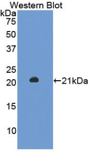 Used in DAB staining on fromalin fixed paraffin-embedded Stomach tissue