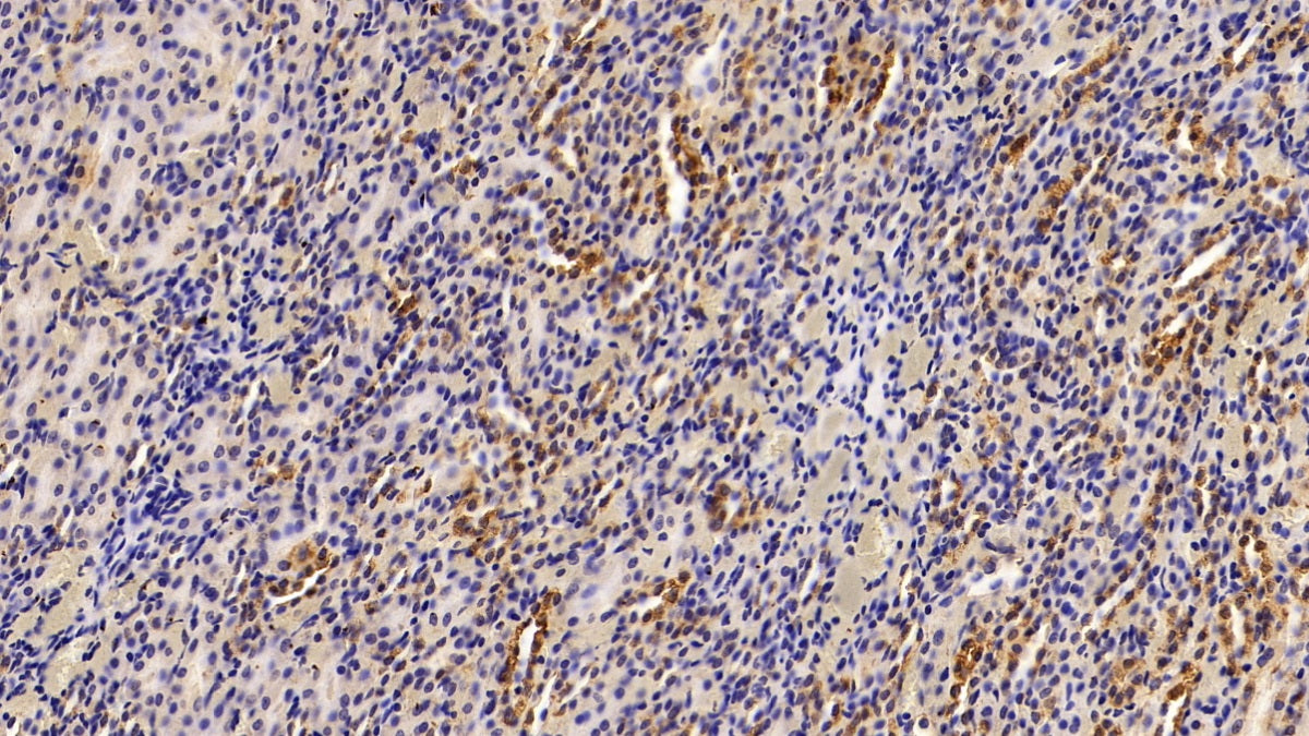 Enolase 1 (ENO1) Polyclonal Antibody - image 4