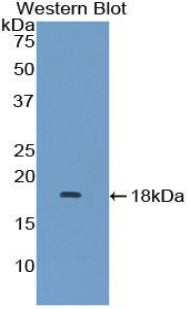 Used in DAB staining on fromalin fixed paraffin-embedded Liver tissue