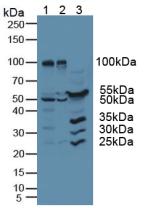 Western Blot; Sample: Recombinant RI, Human.