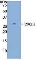 DAB staining on IHC-P; Samples: Human Prostate Tissue; Primary Ab: 10µg/ml Rabbit Anti-Human RI Antibody Second Ab: 2µg/mL HRP-Linked Caprine Anti-Rabbit IgG Polyclonal Antibody