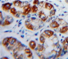 Integrin Alpha E (ITGaE) Polyclonal Antibody - image 3