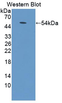 Adenylate Cyclase 9 (ADCY9) Polyclonal Antibody - image 2