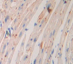 Adenylate Cyclase 9 (ADCY9) Polyclonal Antibody - image 3