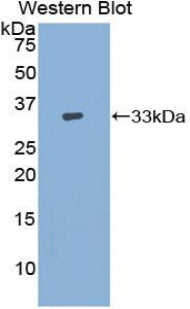 Adenylate Cyclase 9 (ADCY9) Polyclonal Antibody - image 2
