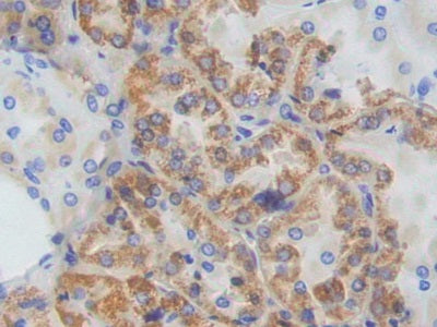 DAB staining on fromalin fixed paraffin-embedded Liver tissue)