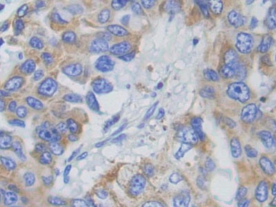 Adenylate Cyclase 9 (ADCY9) Polyclonal Antibody - image 4