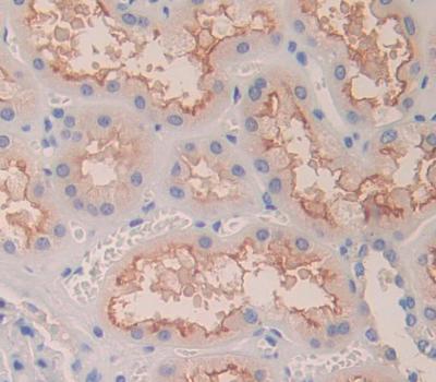 Cluster Of Differentiation 99 (CD99) Polyclonal Antibody - image 3
