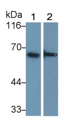 DAB staining on IHC-P; Samples: Human Rectum Tissue; Primary Ab: 20µg/ml Rabbit Anti-Human IFNa/bR1 Antibody Second Ab: 2µg/mL HRP-Linked Caprine Anti-Rabbit IgG Polyclonal Antibody