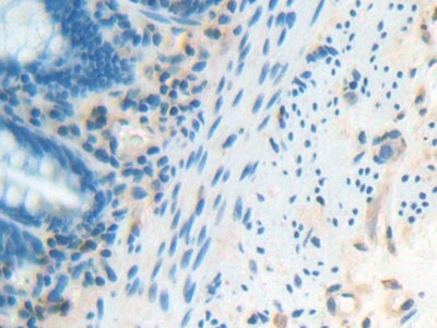DAB staining on IHC-P; Samples: Human Liver Tissue.