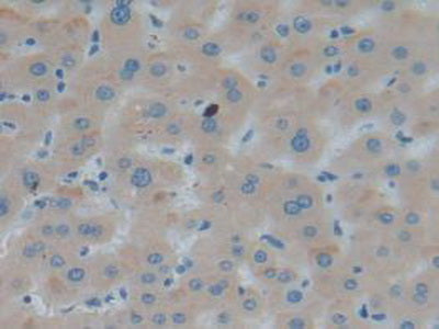 Interferon Alpha/Beta Receptor 1 (IFNa/bR1) Polyclonal Antibody - image 5