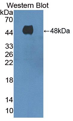 Adenylate Cyclase 8, Brain (ADCY8) Polyclonal Antibody - image 2