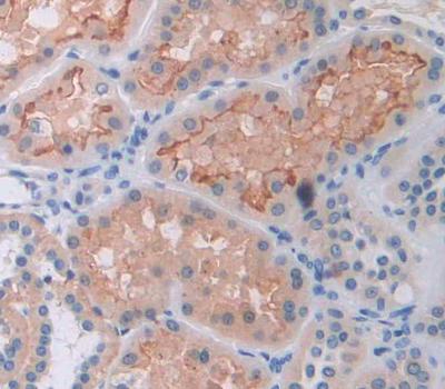 Adenylate Cyclase 8, Brain (ADCY8) Polyclonal Antibody - image 3