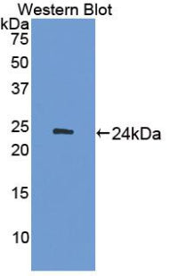 DAB staining on IHC-P; Samples: Mouse Kidney Tissue; Primary Ab: 20μg/ml Rabbit Anti-Mouse ADCY7 Antibody Second Ab: 2µg/mL HRP-Linked Caprine Anti-Rabbit IgG Polyclonal Antibody