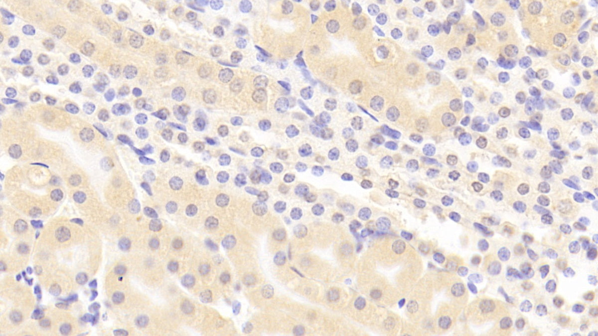 DAB staining on fromalin fixed paraffin- embedded Kidney tissue)