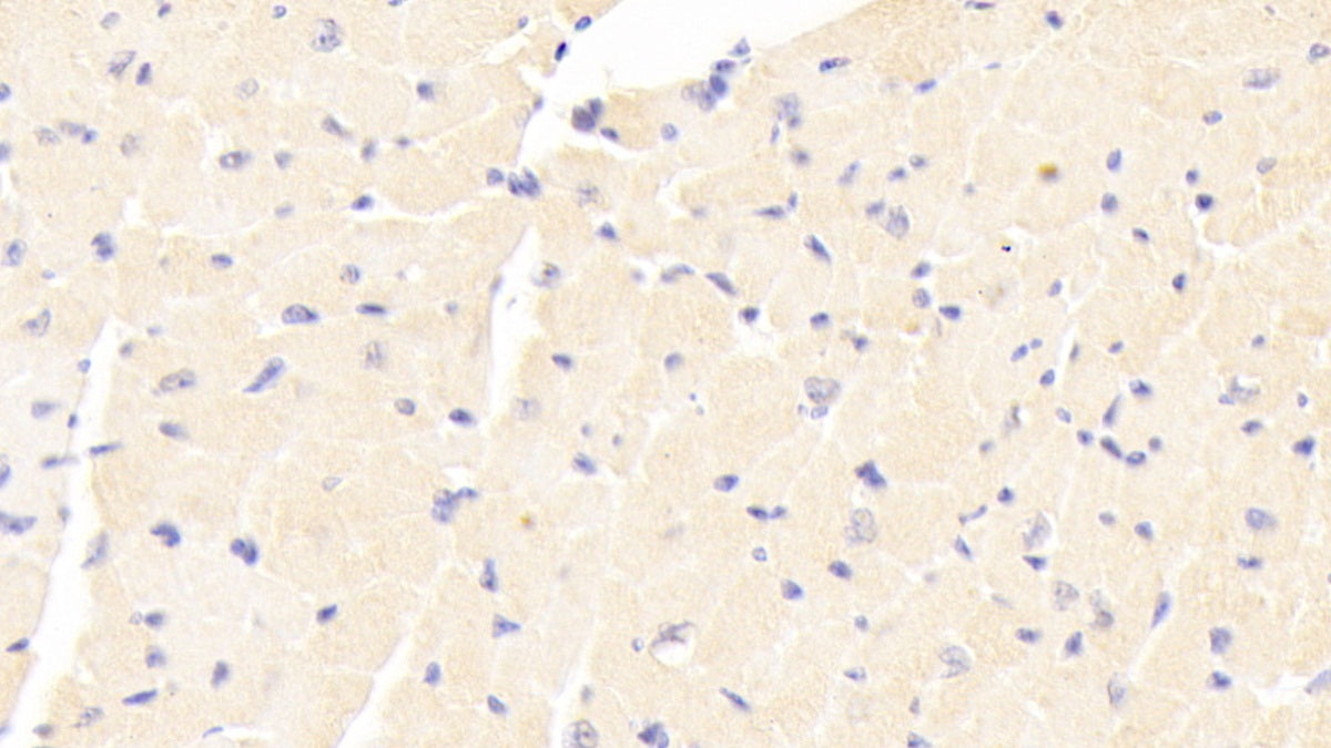Adenylate Cyclase 7 (ADCY7) Polyclonal Antibody - image 5