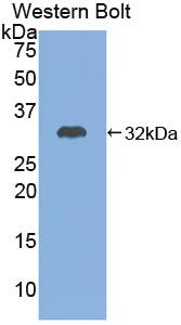 Adenylate Cyclase 7 (ADCY7) Polyclonal Antibody - image 2
