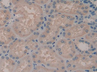DAB staining on fromalin fixed paraffin- embedded liver tissue)