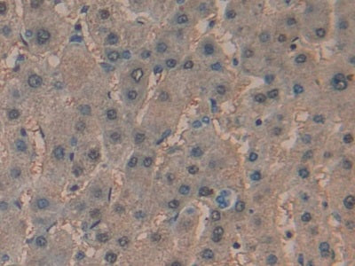 Adenylate Cyclase 7 (ADCY7) Polyclonal Antibody - image 4