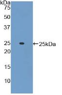 Western Blot; Sample: Human Serum; ; Primary Ab: 2µg/mL Rabbit Anti-Mouse ADCY6 Antibody; Second Ab: 0.2µg/mL HRP-Linked Caprine Anti-Rabbit IgG Polyclonal Antibody;