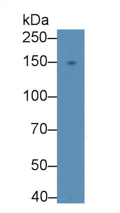 DAB staining on IHC-P; Samples: Mouse Heart Tissue; Primary Ab: 10µg/ml Rabbit Anti-Mouse ADCY6 Antibody Second Ab: 2µg/mL HRP-Linked Caprine Anti-Rabbit IgG Polyclonal Antibody