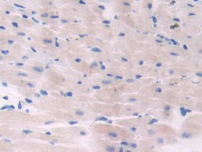 DAB staining on IHC-P; Samples: Mouse Kidney Tissue.