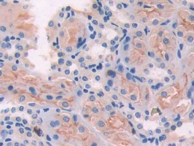 Adenylate Cyclase 6 (ADCY6) Polyclonal Antibody - image 5