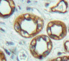 Adenylate Cyclase 6 (ADCY6) Polyclonal Antibody - image 3