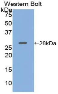 Adenylate Cyclase 5 (ADCY5) Polyclonal Antibody - image 2