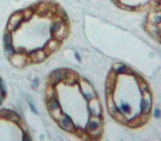Adenylate Cyclase 5 (ADCY5) Polyclonal Antibody - image 3