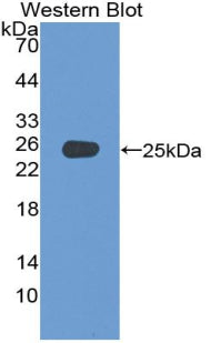 Adenylate Cyclase 4 (ADCY4) Polyclonal Antibody - image 2