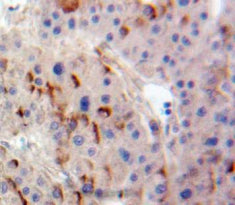 Adenylate Cyclase 4 (ADCY4) Polyclonal Antibody - image 3