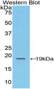 Cluster Of Differentiation 97 (CD97) Polyclonal Antibody - image 2