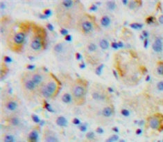 Cluster Of Differentiation 97 (CD97) Polyclonal Antibody - image 3