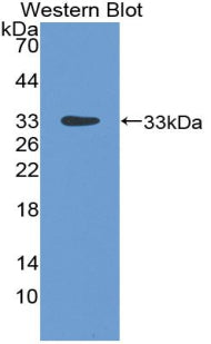 DAB staining on IHC-P; Samples: Rat Ovary Tissue; Primary Ab: 20μg/ml Rabbit Anti-Rat LBP Antibody Second Ab: 2µg/mL HRP-Linked Caprine Anti-Rabbit IgG Polyclonal Antibody