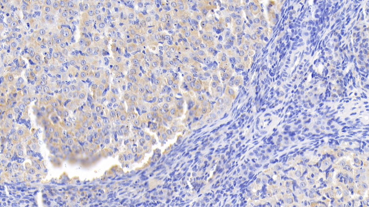 DAB staining on fromalin fixed paraffin-embedded Liver tissue)