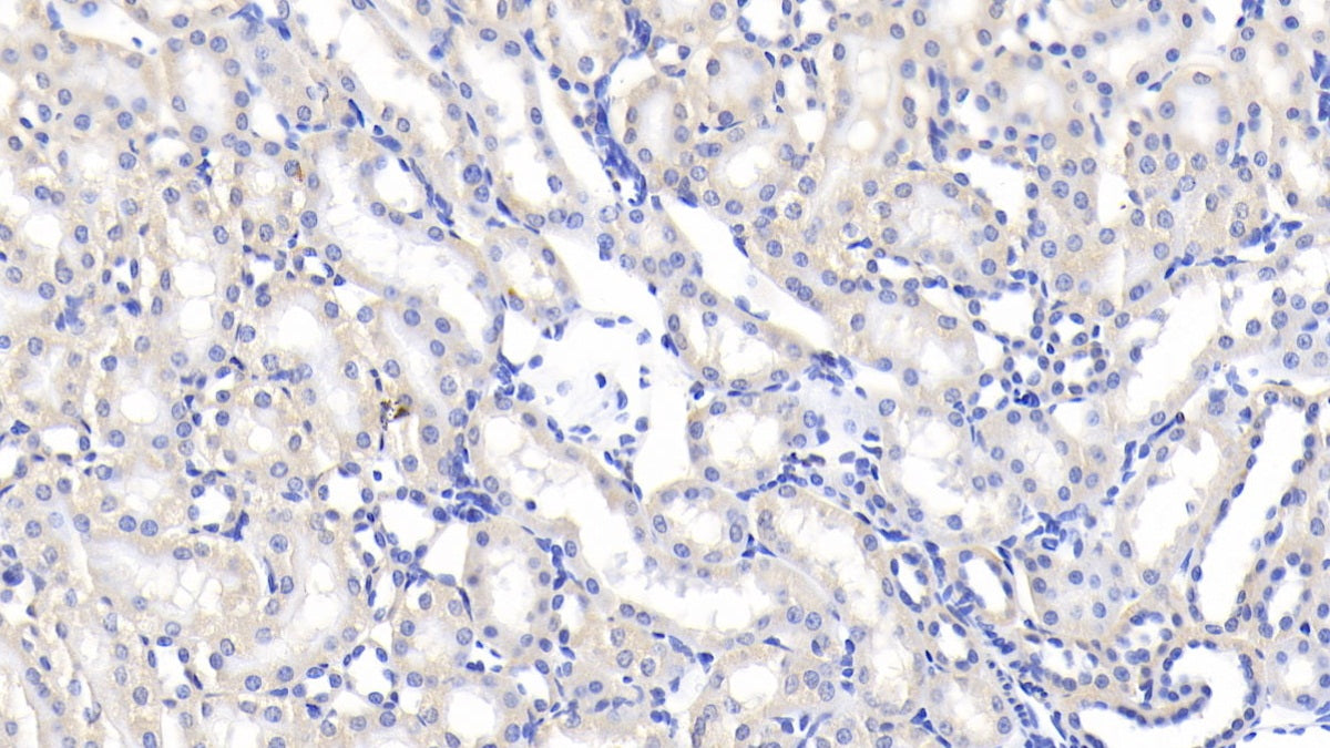Lipopolysaccharide Binding Protein (LBP) Polyclonal Antibody - image 5