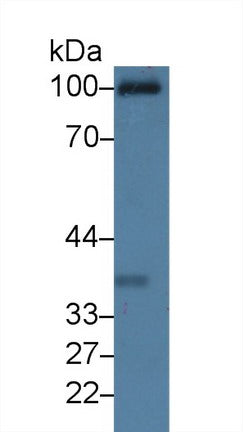Western Blot; Sample: Recombinant protein.