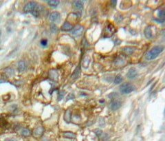 Complement Component 1, Q Receptor (C1qR1) Polyclonal Antibody - image 4