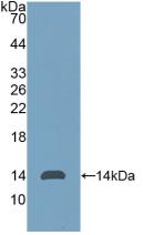 DAB staining on IHC-P; Samples: Human Colorectal cancer Tissue; Primary Ab: 10µg/ml Rabbit Anti-Human Thy1 Antibody Second Ab: 2µg/mL HRP-Linked Caprine Anti-Rabbit IgG Polyclonal Antibody