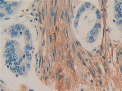 DAB staining on IHC-P; Samples: Human Kidney Tissue.
