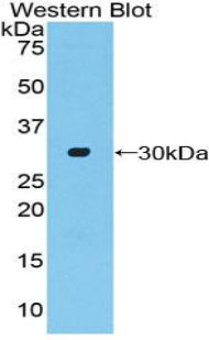 Adenylate Cyclase 2, Brain (ADCY2) Polyclonal Antibody - image 2