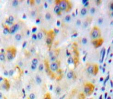 Adenylate Cyclase 2, Brain (ADCY2) Polyclonal Antibody - image 3