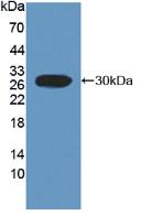 DAB staining on IHC-P; Samples: Rat Kidney Tissue;  Primary Ab: 10µg/ml Rabbit Anti-Rat FcaR Antibod