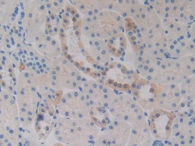 DAB staining on IHC-P; Samples: Rat Kidney Tissue