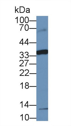 Fc Fragment Of IgA Receptor (FcaR) Polyclonal Antibody - image 3
