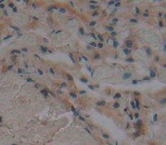 Fc Fragment Of IgA Receptor (FcaR) Polyclonal Antibody - image 4